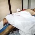 A handout picture released by the official Syrian Arab News Agency (SANA) on July 14, 2019, shows a wounded civilian lying on a hospital bed following a rocket attack in the government-held northern city of Aleppo. Rockets fired by jihadists today kill...