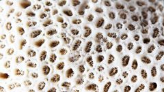 Dr. Pimple Popper Clears Blackheads On Hairy Nose