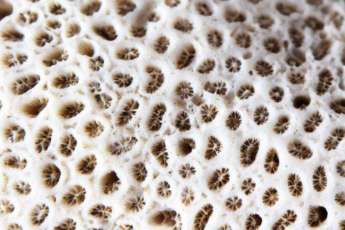 Dr. Pimple Popper Clears Blackheads On Hairy Nose