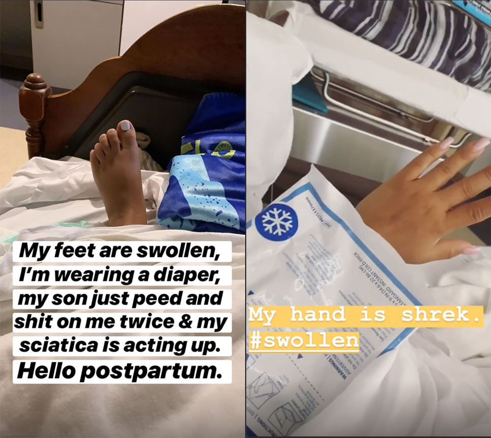 Snooki's Swollen And In Pain After Giving Birth