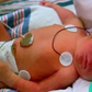 New Jersey Baby Survives Rare Diagnosis
