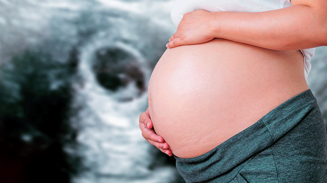 Fetal movement gif (Smart Parenting)