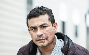 Victim of Milwaukee Acid Attack Says He Was Told to 'Go Back to Your Country'