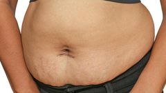 Post baby belly (BabyCentre)