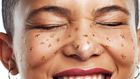 The Ingredient That Gets Rid Of Blackheads
