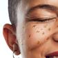 The Ingredient That Gets Rid Of Blackheads