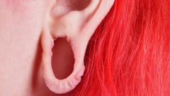 Dr. Pimple Popper Repairs a Stretched Earlobe