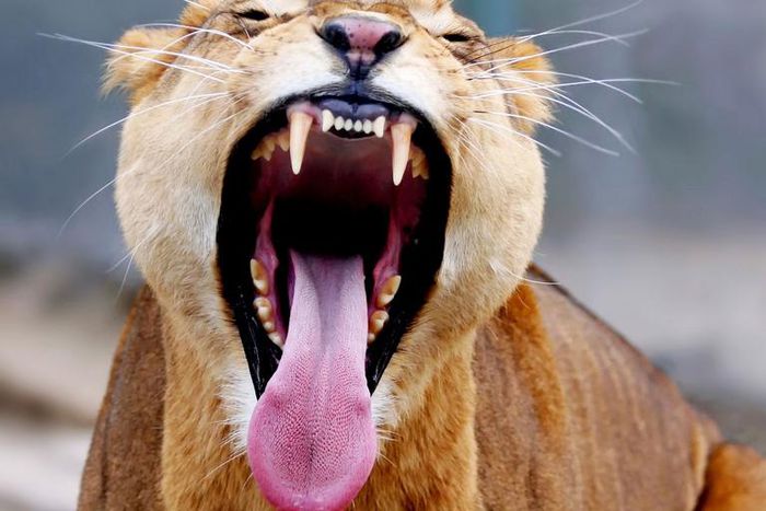 Dr. Pimple Popper Unearths Cyst With 'Teeth'