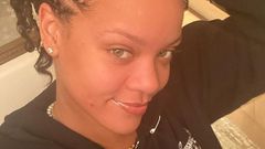 Rihanna Just Posted A No-Makeup Selfie With Pimple