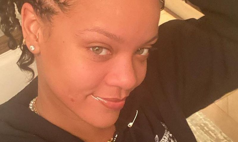 Rihanna Just Posted A No-Makeup Selfie With Pimple