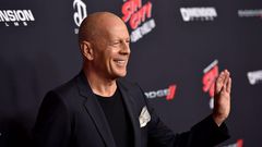 40 Celebrities Who've Shaved Their Heads