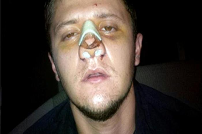 'El Menchito' Ruben Oseguera Gonzalez (pictured in 2015 apparently after plastic surgery) was number two in the powerful Jalisco New Generation drug cartel
