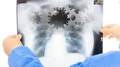 Tests of KHN Patient suspected to have Coronavirus released