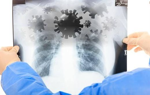 Tests of KHN Patient suspected to have Coronavirus released