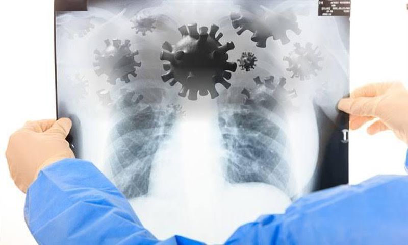 Tests of KHN Patient suspected to have Coronavirus released