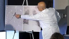 Facing 'Certain Death,' Boy With Vaping Injury Gets Double Lung Transplant