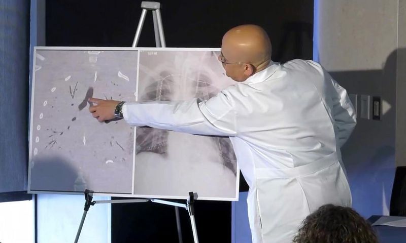 Facing 'Certain Death,' Boy With Vaping Injury Gets Double Lung Transplant