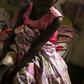 Nine-year-old Edwige Kalivanda is just one of many people being treated for horrific wounds and trauma from attacks by rebels in DR Congo