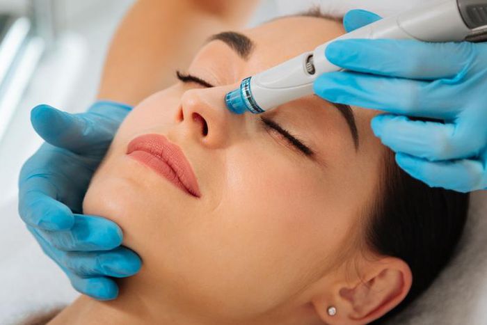 Say Goodbye to Blackheads with a Hydrafacial