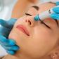 Say Goodbye to Blackheads with a Hydrafacial