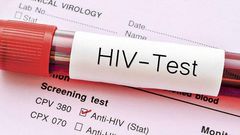 Zero HIV Cases in this county