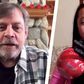 Watch Mark Hamill's Reaction to Bionic Arm