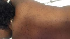 What your acne means (Elite Daily)
