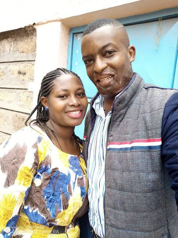 Kelvin Kairo with his Wife. I went on Facebook Live to commit Suicide- Acid attack survivor Kelvin Kairo tells it all