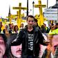 Antoine Boudinet, a protester who lost his right hand to a GLI-F4 stun grenade at a protest by injured protesters last September in Bordeaux