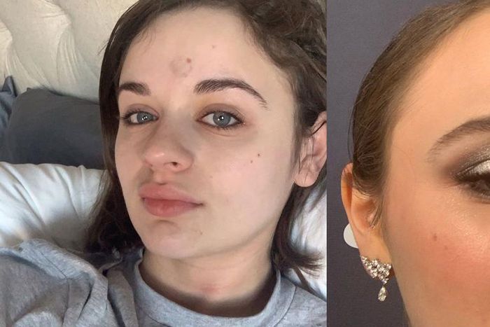 Patricia Arquette Hit Joey King With Golden Globe