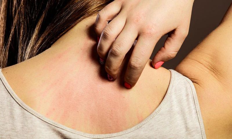 23 Causes Of Skin Redness (With Photos!)