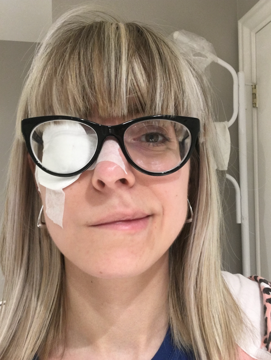 'Ramsay Hunt Syndrome Paralyzed Half My Face'