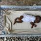 This foster child suffering from malnutrition is one of two hosted by Rose Boncoeur, in Port-au-Prince, Haiti, even though she gets no financial support to feed and clothe them