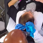 This Guy Tattooed His Scalp to Hide His Baldness