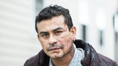 Suspect Charged With Hate Crime in Acid Attack on Hispanic Man