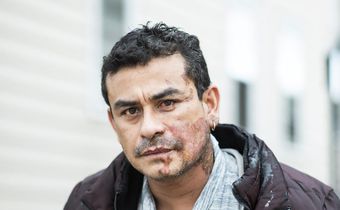 Suspect Charged With Hate Crime in Acid Attack on Hispanic Man