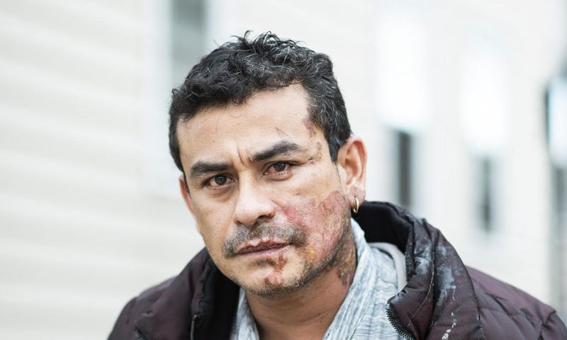 Suspect Charged With Hate Crime in Acid Attack on Hispanic Man