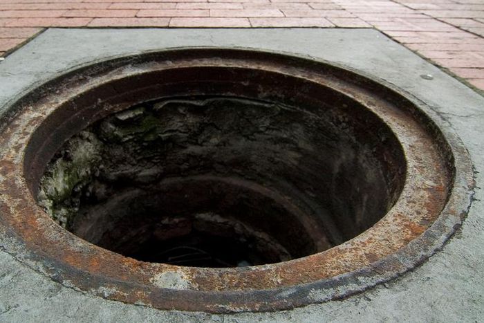 Dr. Pimple Popper Squeezes a Crusty Blackhead