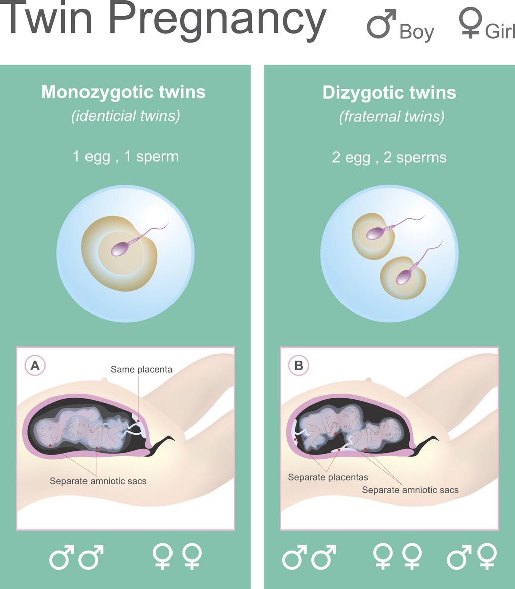 Twin Pregnancy.