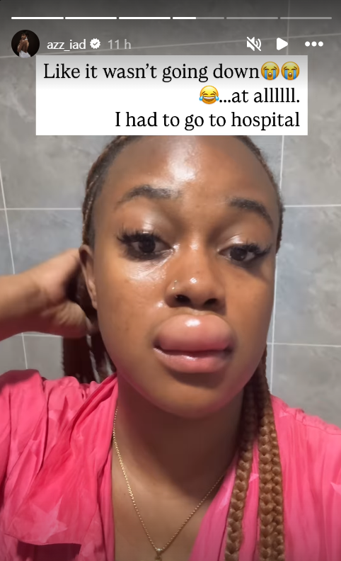 What happened to Azziad? Fans link her lip to 'spiritual transaction' & botched filler