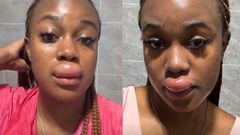 What happened to Azziad? Fans link her swollen lip to 'spiritual transaction'