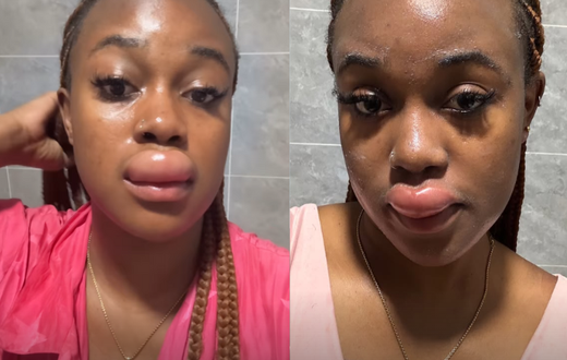 What happened to Azziad? Fans link her swollen lip to 'spiritual transaction'