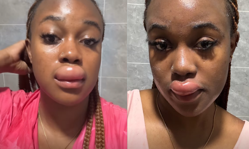 What happened to Azziad? Fans link her swollen lip to 'spiritual transaction'