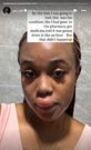 What happened to Azziad? Fans link her lip to 'spiritual transaction' & botched filler