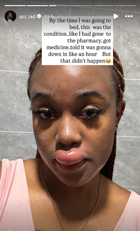 What happened to Azziad? Fans link her lip to 'spiritual transaction' & botched filler