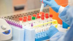 Coronavirus: Why Gov’t must supply free test kits to encourage mass and voluntary testing