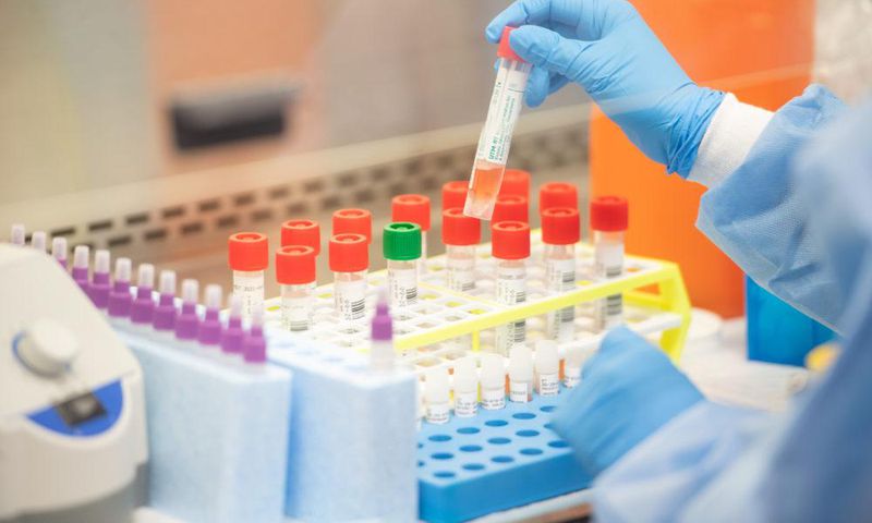 Coronavirus: Why Gov’t must supply free test kits to encourage mass and voluntary testing