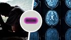 Between Antidepressant Pills and a Hard Place