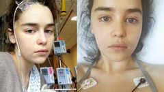 Emilia Clarke Shares New Pics After Brain Surgery
