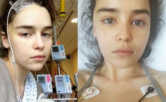 Emilia Clarke Shares New Pics After Brain Surgery